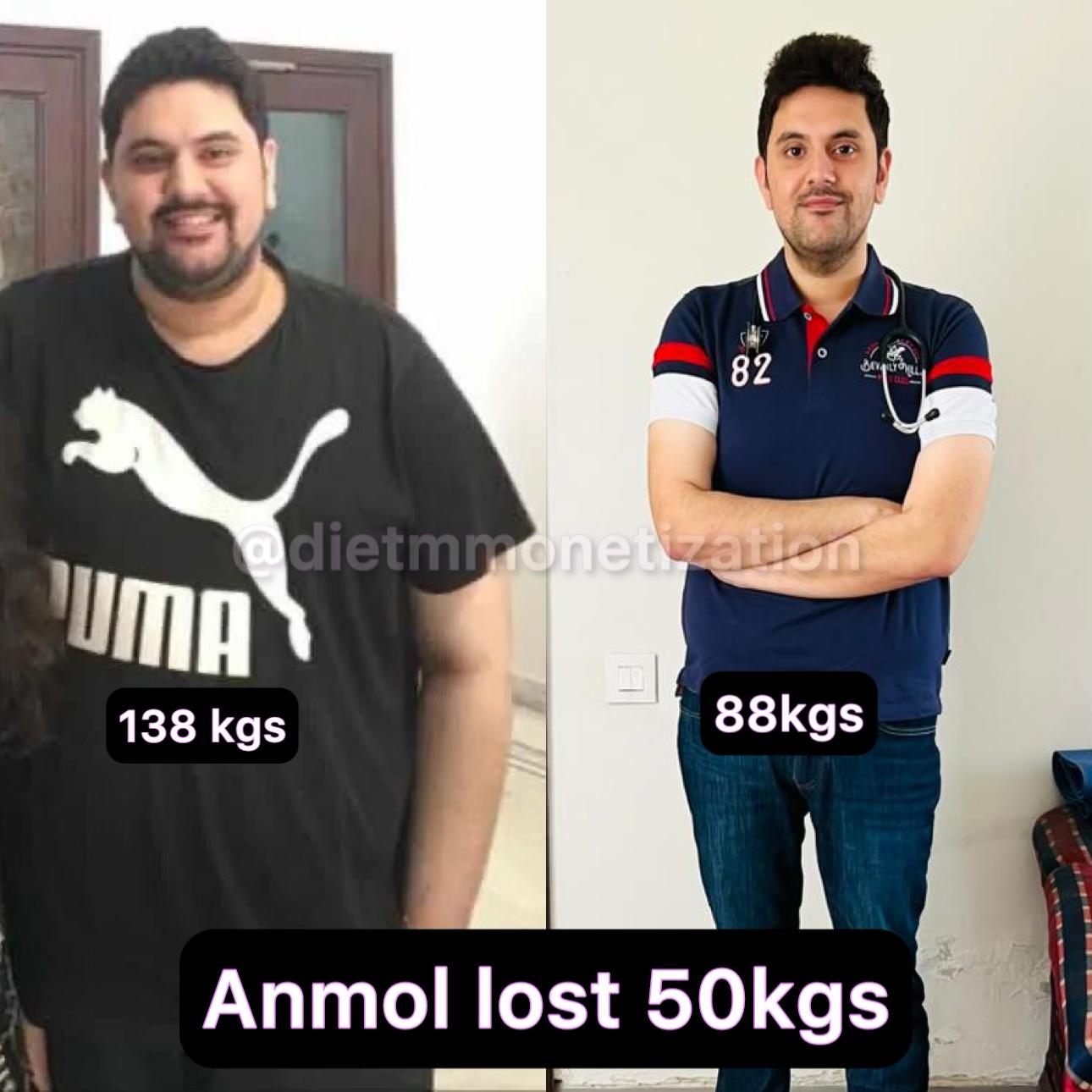 Anmol lost 50kgs, down from 138kgs to 88kgs