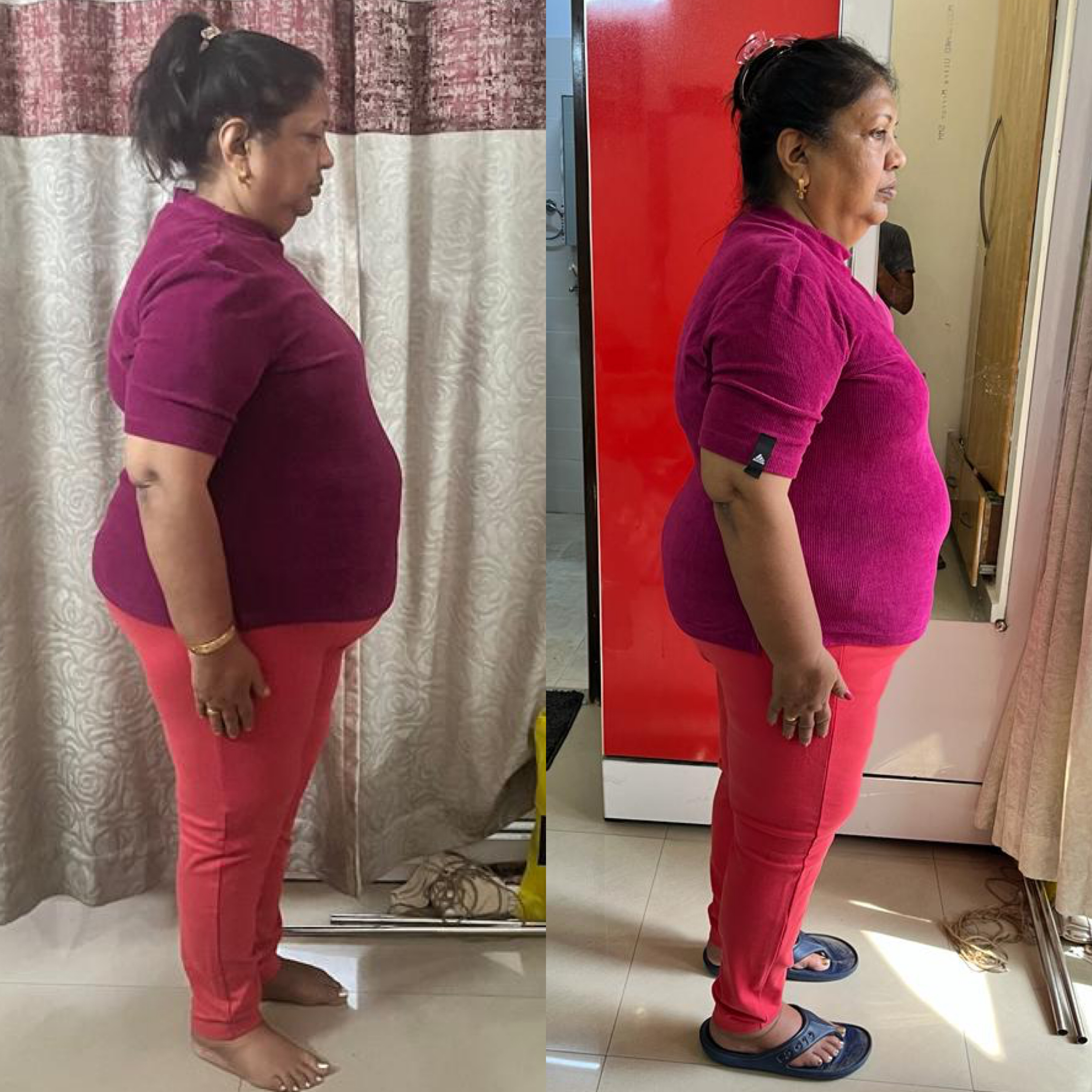 Client's side-profile before-and-after transformation